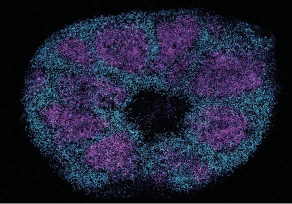 This image shows a section of an organoid. Organoids are lab-grown tissues that model the human brain. A new study used brain organoids to probe key protein interactions that may be linked to profound autism.